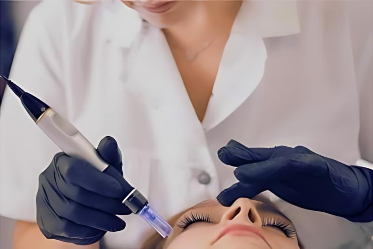 Aesthetic practitioner performing a microneedling Dermapen treatment on a client's face. The image shows the precise use of the Dermapen device to create micro-injuries, stimulating collagen production and improving skin texture, reducing fine lines, and minimizing scars for a rejuvenated appearance.