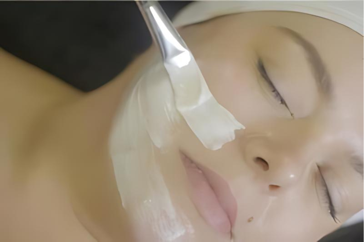 Aesthetic practitioner performing the ZO 3-Step Peel on a client's face. The image shows the application of a powerful chemical peel designed to exfoliate, stimulate skin renewal, and enhance hydration, effectively reducing fine lines, pigmentation, and acne scars for a smoother, brighter complexion.