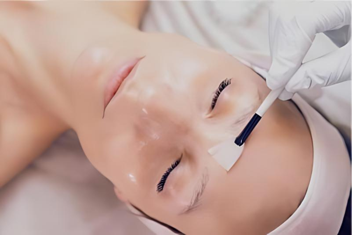 Aesthetic practitioner applying the Obagi Blue Radiance Peel to a client's face. The image shows the peel treatment process aimed at exfoliating dead skin cells, reducing fine lines, and improving skin texture and tone for a smoother, brighter complexion.