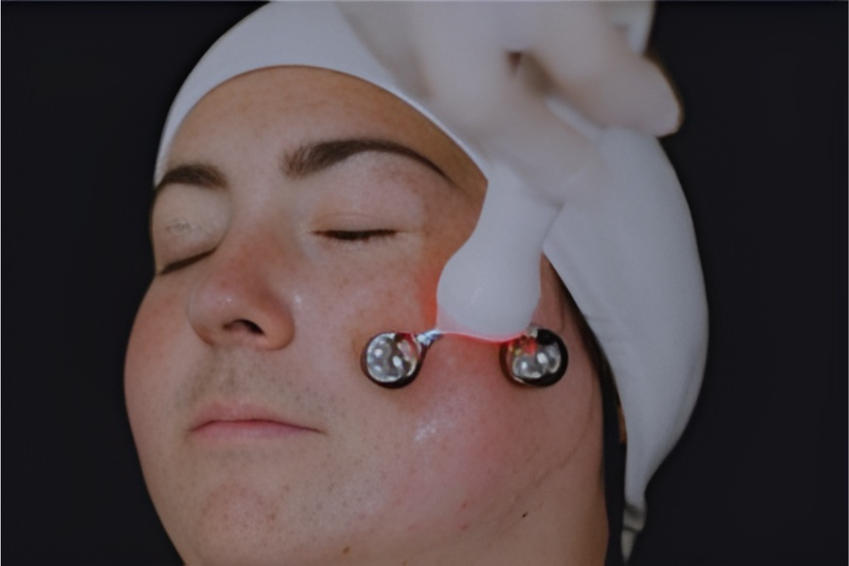 Aesthetic practitioner using Ultraformer III on a client's face. The image captures the non-invasive HIFU (High-Intensity Focused Ultrasound) treatment process designed to tighten and lift the skin, enhancing collagen production and reducing wrinkles for a more youthful appearance.